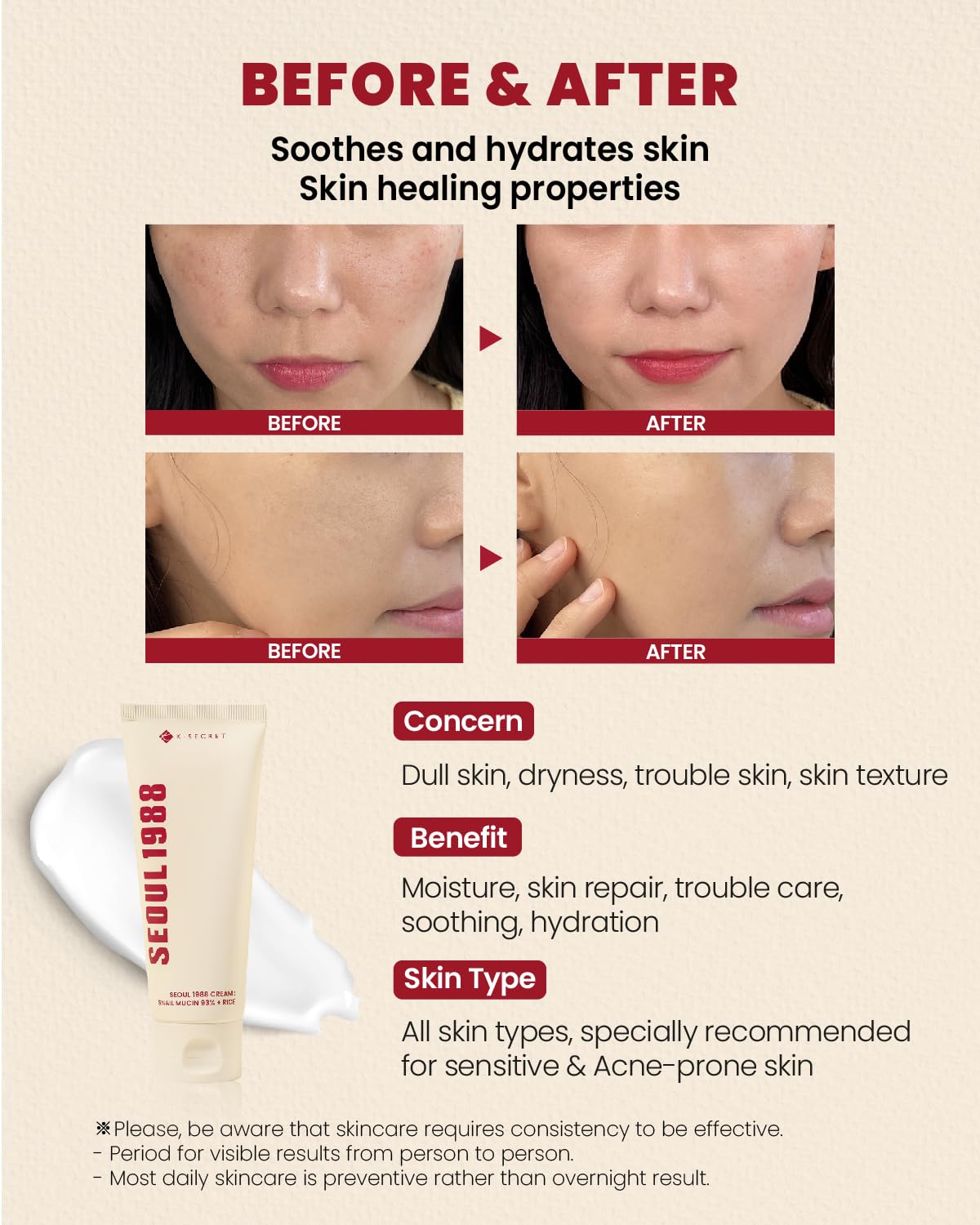 71OhJmMGaUL._SL1500_