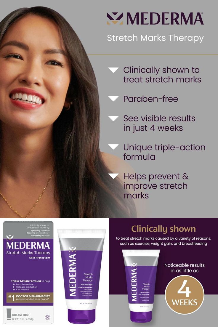 💜 Mederma Stretch Marks Therapy – Prevent & Fade Stretch Marks! 🤰✨